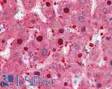 FAH Antibody - Anti-FAH antibody IHC of human liver. Immunohistochemistry of formalin-fixed, paraffin-embedded tissue after heat-induced antigen retrieval. Antibody concentration 5 ug/ml.  This image was taken for the unconjugated form of this product. Other forms have not been tested.