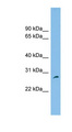 FAM109A Antibody - FAM109A antibody Western blot of U937 cell lysate. This image was taken for the unconjugated form of this product. Other forms have not been tested.