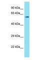 FAM114A1 / Noxp20 Antibody - FAM114A1 antibody Western Blot of A549. Antibody dilution: 1 ug/ml.  This image was taken for the unconjugated form of this product. Other forms have not been tested.