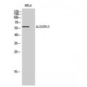 FAM117B / ALS2CR13 Antibody - Western blot of ALS2CR13 antibody