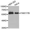 FAM117B / ALS2CR13 Antibody - Western blot analysis of extracts of various cell lines, using FAM117B antibody.