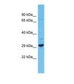 FAM124A Antibody - Western blot of Human Jurkat. FAM124A antibody dilution 1.0 ug/ml.  This image was taken for the unconjugated form of this product. Other forms have not been tested.