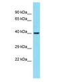 FAM131A Antibody - FAM131A antibody Western Blot of Fetal Lung. Antibody dilution: 1 ug/ml.  This image was taken for the unconjugated form of this product. Other forms have not been tested.