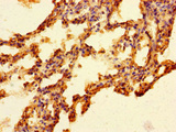 FAM131A Antibody - Immunohistochemistry of paraffin-embedded human lung tissue using FAM131A Antibody at dilution of 1:100