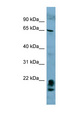 FAM134A Antibody - FAM134A antibody Western blot of HT1080 cell lysate. This image was taken for the unconjugated form of this product. Other forms have not been tested.