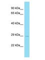FAM156B Antibody - FAM156B antibody Western Blot of 721_B. Antibody dilution: 1 ug/ml.  This image was taken for the unconjugated form of this product. Other forms have not been tested.