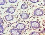 FAM160B1 Antibody - Immunohistochemistry of paraffin-embedded human rectum tissue using antibody at 1:100 dilution.  This image was taken for the unconjugated form of this product. Other forms have not been tested.