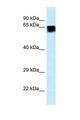 FAM161A Antibody - FAM161A antibody Western blot of Placenta lysate. Antibody concentration 1 ug/ml.  This image was taken for the unconjugated form of this product. Other forms have not been tested.