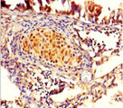 FAM161A Antibody - Immunohistochemistry of paraffin-embedded human lung tissue using FAM161A Antibody at dilution of 1:100