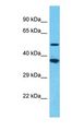 FAM170A Antibody - Western blot of FAM170A Antibody with Jurkat Whole Cell lysate.  This image was taken for the unconjugated form of this product. Other forms have not been tested.