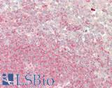 FAM175B / KIAA0157 Antibody - Human Spleen: Formalin-Fixed, Paraffin-Embedded (FFPE)