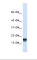FAM176A / TMEM166 Antibody - 293T cell lysate. Antibody concentration: 1.0 ug/ml. Gel concentration: 10-20%.  This image was taken for the unconjugated form of this product. Other forms have not been tested.