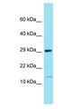 FAM177B Antibody - FAM177B antibody Western Blot of THP-1. Antibody dilution: 1 ug/ml.  This image was taken for the unconjugated form of this product. Other forms have not been tested.