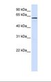 FAM20A Antibody - Fetal liver lysate. Antibody concentration: 1.0 ug/ml. Gel concentration: 12%.  This image was taken for the unconjugated form of this product. Other forms have not been tested.