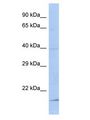 FAM210B Antibody - FAM210B antibody Western Blot of MCF7. Antibody dilution: 1 ug/ml.  This image was taken for the unconjugated form of this product. Other forms have not been tested.