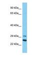 FAM212B Antibody - Western blot of FAM212B Antibody with human Placenta lysate.  This image was taken for the unconjugated form of this product. Other forms have not been tested.