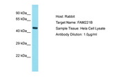FAM221B / C9orf128 Antibody -  This image was taken for the unconjugated form of this product. Other forms have not been tested.