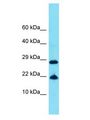 FAM25E Antibody - FAM25E antibody Western Blot of COLO205. Antibody dilution: 1 ug/ml.  This image was taken for the unconjugated form of this product. Other forms have not been tested.