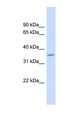 FAM26F Antibody - FAM26F antibody Western blot of Fetal Muscle lysate. This image was taken for the unconjugated form of this product. Other forms have not been tested.