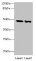 FAM46B Antibody - Western blot All lanes: TENT5B antibody at 6µg/ml Lane 1: 293T whole cell lysate Lane 2: Hela whole cell lysate Secondary Goat polyclonal to rabbit IgG at 1/10000 dilution Predicted band size: 47 kDa Observed band size: 47 kDa