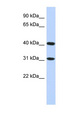 FAM46D Antibody - FAM46D antibody Western blot of HepG2 cell lysate. This image was taken for the unconjugated form of this product. Other forms have not been tested.