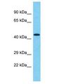 FAM47E Antibody - FAM47E antibody Western Blot of 293T. Antibody dilution: 1 ug/ml.  This image was taken for the unconjugated form of this product. Other forms have not been tested.