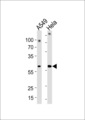 FAM50A Antibody - FAM50A Antibody western blot of A549,HeLa cell line lysates (35 ug/lane). The FAM50A antibody detected the FAM50A protein (arrow).