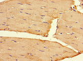 FAM65B / DIFF48 Antibody - Immunohistochemistry of paraffin-embedded human skeletal muscle tissue at dilution 1:100