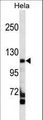 FAM65C Antibody - FAM65C Antibody western blot of HeLa cell line lysates (35 ug/lane). The FAM65C antibody detected the FAM65C protein (arrow).