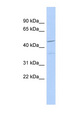 FAM81A Antibody - FAM81A antibody Western blot of Fetal Brain lysate. This image was taken for the unconjugated form of this product. Other forms have not been tested.