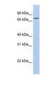 FAM82A1 Antibody - FAM82A1 antibody Western blot of Jurkat lysate. This image was taken for the unconjugated form of this product. Other forms have not been tested.