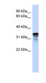 FAM82B Antibody - FAM82B antibody Western blot of Transfected 293T cell lysate. This image was taken for the unconjugated form of this product. Other forms have not been tested.