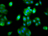 FAM83D Antibody - Immunofluorescence staining of HepG2 cells diluted at 1:133, counter-stained with DAPI. The cells were fixed in 4% formaldehyde, permeabilized using 0.2% Triton X-100 and blocked in 10% normal Goat Serum. The cells were then incubated with the antibody overnight at 4°C.The Secondary antibody was Alexa Fluor 488-congugated AffiniPure Goat Anti-Rabbit IgG (H+L).