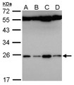 FAM9B Antibody - Sample (30 ug of whole cell lysate). . A: Hela. , B: Hep G2 . , C: Molt-4 . , D: Raji. . 12% SDS PAGE. . FAM9B antibody diluted at 1:5000.
