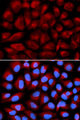 FANCC Antibody - Immunofluorescence analysis of U2OS cells using FANCC antibody. Blue: DAPI for nuclear staining.