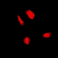 FANCC Antibody - Immunofluorescent analysis of FANCC staining in U2OS cells. Formalin-fixed cells were permeabilized with 0.1% Triton X-100 in TBS for 5-10 minutes and blocked with 3% BSA-PBS for 30 minutes at room temperature. Cells were probed with the primary antibody in 3% BSA-PBS and incubated overnight at 4 deg C in a humidified chamber. Cells were washed with PBST and incubated with a DyLight 594-conjugated secondary antibody (red) in PBS at room temperature in the dark.