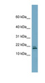 FANCD2OS Antibody - C3orf24 antibody Western blot of NCI-H226 cell lysate. This image was taken for the unconjugated form of this product. Other forms have not been tested.