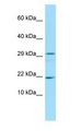 FANCD2OS Antibody - FANCD2OS antibody Western Blot of Rat Pancreas.  This image was taken for the unconjugated form of this product. Other forms have not been tested.