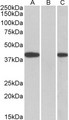 FANCF Antibody - HEK293 lysate (10ug protein in RIPA buffer) overexpressing Human FANCF with C-terminal MYC tag probed with (0.5ug/ml) in Lane A and probed with anti-MYC Tag (1/1000) in lane C. Mock-transfected HEK293 probed (1mg/ml) in Lane B. Prima