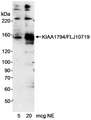 FANCI Antibody - Detection of Human KIAA1794/FLJ10719 by Western Blot. Samples: Nuclear extract (5 and 20 ug) from HeLa cells. Antibody: Affinity purified rabbit anti-KIAA1794/FLJ10719 antibody used at 0.2 ug/ml. Detection: Chemiluminescence with an exposure time of 15 minutes.