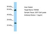 FARSB Antibody -  This image was taken for the unconjugated form of this product. Other forms have not been tested.