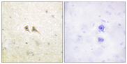 FASLG / Fas Ligand Antibody - Immunohistochemistry analysis of paraffin-embedded human brain tissue, using FAS ligand Antibody. The picture on the right is blocked with the synthesized peptide.