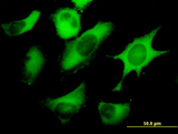 FASN / Fatty Acid Synthase Antibody - Immunofluorescence of monoclonal antibody to FASN on HeLa cell (antibody concentration 10 ug/ml).