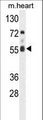 FASTK / FAST Antibody - Western blot of hFASTK-R534 in mouse heart tissue lysates (35 ug/lane). FASTK (arrow) was detected using the purified antibody.