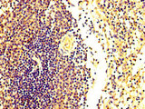 FASTKD2 Antibody - Immunohistochemistry image at a dilution of 1:300 and staining in paraffin-embedded human spleen tissue performed on a Leica BondTM system. After dewaxing and hydration, antigen retrieval was mediated by high pressure in a citrate buffer (pH 6.0) . Section was blocked with 10% normal goat serum 30min at RT. Then primary antibody (1% BSA) was incubated at 4 °C overnight. The primary is detected by a biotinylated secondary antibody and visualized using an HRP conjugated SP system.
