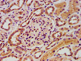 FASTKD5 Antibody - Immunohistochemistry image at a dilution of 1:400 and staining in paraffin-embedded human kidney tissue performed on a Leica BondTM system. After dewaxing and hydration, antigen retrieval was mediated by high pressure in a citrate buffer (pH 6.0) . Section was blocked with 10% normal goat serum 30min at RT. Then primary antibody (1% BSA) was incubated at 4 °C overnight. The primary is detected by a biotinylated secondary antibody and visualized using an HRP conjugated SP system.