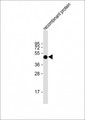 FAT1 / FAT Antibody - Anti-FAT1 Antibody at 1:2000 dilution + recombinant protein Lysates/proteins at 20 ug per lane. Secondary Goat Anti-mouse IgG, (H+L), Peroxidase conjugated at 1:10000 dilution. Predicted band size: 506 kDa. Blocking/Dilution buffer: 5% NFDM/TBST.