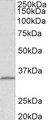 FBL / FIB / Fibrillarin Antibody - FBL antibody (0.1 ug/ml) staining of HEK293 lysate (35 ug protein in RIPA buffer). Primary incubation was 1 hour. Detected by chemiluminescence.