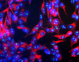 FBL / FIB / Fibrillarin Antibody - Human SH-SY5Y cells stained with FBL / FIB / Fibrillarin antibody, showing prominent specular nucleolar staining. The nuclei are counter stained with blue DAPI DNA stain, so these spots appear very pale blue. The cells are also stained with chicken antibody to neurofilament NF-H.