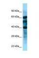 FBL8 / FBXL8 Antibody - FBXL8 antibody Western blot of Fetal Kidney lysate. Antibody concentration 1 ug/ml.  This image was taken for the unconjugated form of this product. Other forms have not been tested.
